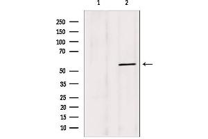 Western blot analysis of extracts from mouse brain, using BBS4 antibody.