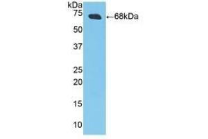 Detection of Recombinant CKM, Porcine using Polyclonal Antibody to Creatine Kinase, Muscle (CKM) (CKM antibody  (AA 11-367))