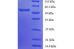 SDS-PAGE (SDS) image for Smg-7 Homolog, Nonsense Mediated mRNA Decay Factor (SMG7) (AA 19-550), (partial) protein (ABIN5710916) (SMG7 Protein (AA 19-550, partial))
