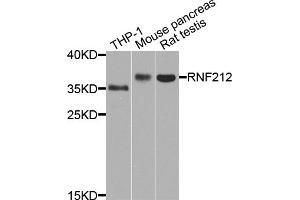 Western blot analysis of extracts of various cell lines, using RNF212 antibody (ABIN5971848) at 1/1000 dilution. (RNF212 antibody)