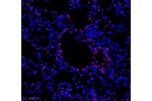 Immunofluorescence of paraffin embedded mouse lung using groucho (ABIN7075961) at dilution of 1:1000 (300x lens) (TLE1 antibody)