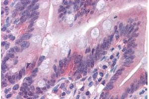 Human Small Intestine: Formalin-Fixed, Paraffin-Embedded (FFPE) (GSDMD antibody  (AA 1-485))