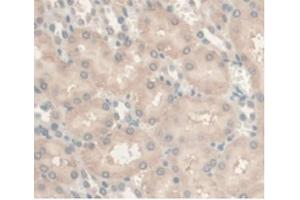 IHC-P analysis of Rat Kidney Tissue, with DAB staining. (Androgen Receptor antibody  (AA 491-679))