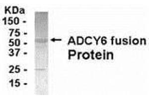 Western Blotting (WB) image for anti-Adenylate Cyclase 6 (ADCY6) (AA 1-121) antibody (ABIN2467944) (ADCY6 antibody  (AA 1-121))