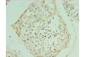 Immunohistochemistry of paraffin-embedded human testis tissue using ABIN7175475 at dilution of 1:100 (VAMP2 antibody  (AA 1-94))
