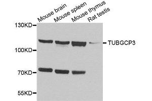 Western blot analysis of extracts of various cell lines, using TUBGCP3 antibody. (TUBGCP3 antibody  (AA 1-250))