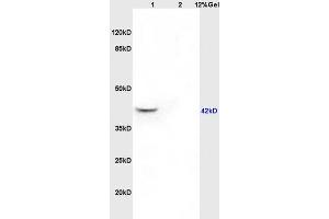 Lane 1: rat brain lysates Lane 2: rat kidney lysates probed with Anti GNAQ/G? (GNAQ antibody  (AA 51-150))