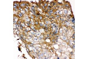Immunohistochemistry (Paraffin-embedded Sections) (IHC (p)) image for anti-Fibroblast Growth Factor Receptor 4 (FGFR4) (AA 22-206) antibody (ABIN3042391) (FGFR4 antibody  (AA 22-206))