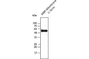 Western Blotting (WB) image for anti-SARS-CoV-2 Membrane Protein (SARS-CoV-2 M) (C-Term) antibody (ABIN7273010) (SARS-CoV-2 Membrane Protein antibody  (C-Term))