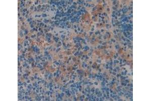 Figure. (GZMM antibody  (AA 19-251))