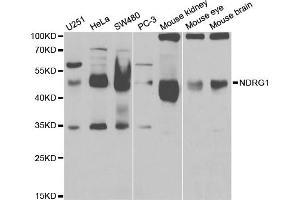 Western blot analysis of extracts of various cell lines, using NDRG1 antibody (ABIN5971169) at 1/1000 dilution. (NDRG1 antibody)