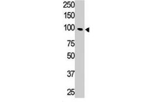 The Tlr5 polyclonal antibody  is used in Western blot to detect TLR5 in HL-60 cell lysate. (TLR5 antibody  (N-Term))
