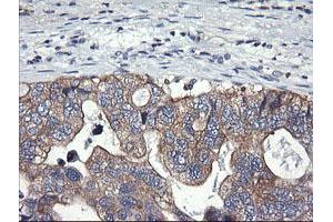 Image no. 2 for anti-Phosphatidylinositol-4-Phosphate 3-Kinase, Catalytic Subunit Type 2 beta (PIK3C2B) antibody (ABIN1500198) (PIK3C2B antibody)