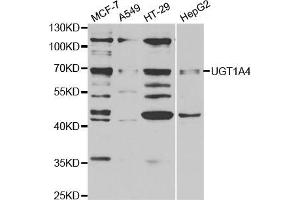 Western blot analysis of extracts of various cell lines, using μgT1A4 antibody (ABIN5973231) at 1/1000 dilution. (UGT1A4 antibody)