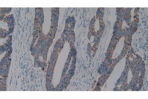 Immunohistochemistry (IHC) image for anti-Complement Component 1, Q Subcomponent Binding Protein (C1QBP) (AA 76-282) antibody (ABIN7432316)