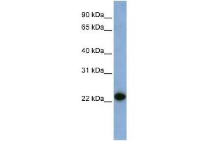 WB Suggested Anti-CAV1 Antibody Titration:  0. (Caveolin-1 antibody  (N-Term))