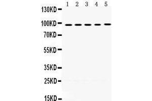 Western Blotting (WB) image for anti-Minichromosome Maintenance Deficient 8 (MCM8) (AA 809-840), (C-Term) antibody (ABIN3042508) (MCM8 antibody  (C-Term))