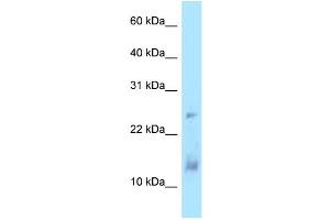 WB Suggested Anti-DYNLL1 Antibody Titration: 1.