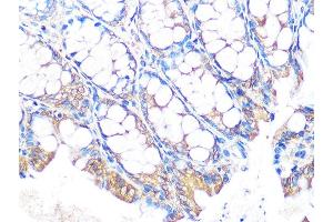 Immunohistochemistry of paraffin-embedded mouse colon using MUC2 Rabbit mAb (ABIN7268689) at dilution of 1:100 (40x lens).