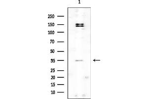 anti-Monoacylglycerol O-Acyltransferase 2 (MOGAT2) antibody