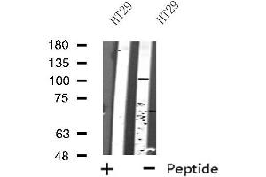 Western blot analysis of extracts from HT29 cells, using SP100 antibody.