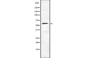 Western blot analysis of CARD9 using K562 whole cell lysates (CARD9 antibody  (C-Term))