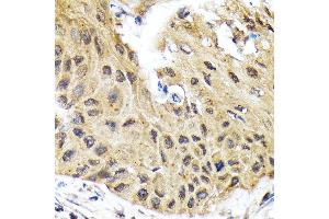 Immunohistochemistry (IHC) image for anti-Eukaryotic Translation Initiation Factor 2B, Subunit 5 Epsilon, 82kDa (EIF2B5) antibody (ABIN7267038)