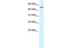 WB Suggested Anti-RIPK1 Antibody Titration:  0. (RIPK1 antibody  (Middle Region))
