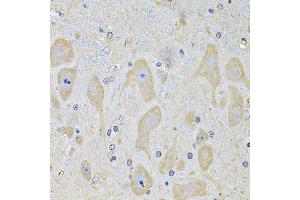 Immunohistochemistry of paraffin-embedded mouse brain using EPHA2 Antibody (ABIN5975494) at dilution of 1/100 (40x lens). (EPH Receptor A2 antibody)