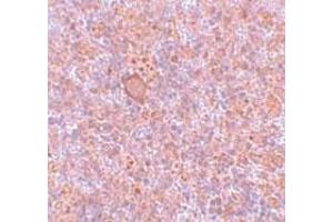 Immunohistochemistry of rat spleen tissue with RBBP8 polyclonal antibody  at 5 ug/mL. (Retinoblastoma Binding Protein 8 antibody  (Internal Region))