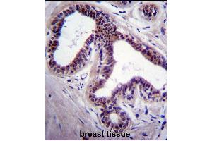PK8 Antibody (C-term) (ABIN391724 and ABIN2841613) immunohistochemistry analysis in forlin fixed and paraffin embedded hun breast tissue followed by peroxidase conjugation of the secondary antibody and DAB staining. (JNK antibody  (C-Term))