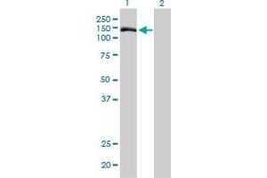 Western Blot analysis of TMEM1 expression in transfected 293T cell line by TMEM1 monoclonal antibody (M01), clone 5B4. (TRAPPC10 antibody  (AA 1162-1257))