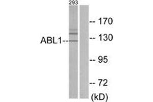 Western blot analysis of extracts from 293 cells, using ABL1 Antibody. (ABL1 antibody  (AA 861-910))