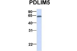 Host:  Rabbit  Target Name:  PDLIM5  Sample Type:  Human Adult Placenta  Antibody Dilution:  1. (PDLIM5 antibody  (N-Term))
