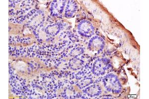 Formalin-fixed and paraffin embedded mouse intestine labeled with Anti-MHC Class II/HLA-DPB1 Polyclonal Antibody, Unconjugated (ABIN753928) at 1:200 followed by conjugation to the secondary antibody and DAB staining.