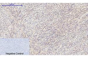 Immunohistochemical analysis of paraffin-embedded human uterus tissue. (EIF2A antibody)