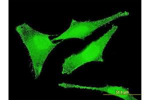 Immunofluorescence of monoclonal antibody to SET on HeLa cell. (SET/TAF-I antibody  (AA 1-277))