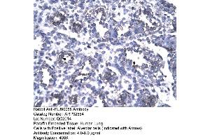 Human Lung (FOXP1 antibody  (N-Term))