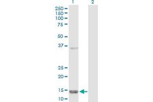 Western Blot analysis of FABP5 expression in transfected 293T cell line by FABP5 MaxPab polyclonal antibody. (FABP5 antibody  (AA 1-135))