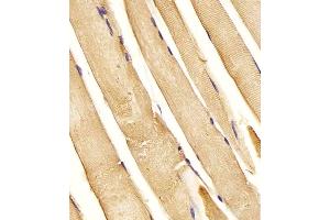 (ABIN6243629 and ABIN6577994) staining CHST1 in Human skeletal muscle tissue sections by Immunohistochemistry (IHC-P - paraformaldehyde-fixed, paraffin-embedded sections). (CHST1 antibody  (C-Term))