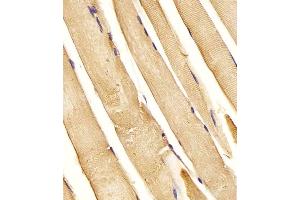 (ABIN6243629 and ABIN6577994) staining CHST1 in Human skeletal muscle tissue sections by Immunohistochemistry (IHC-P - paraformaldehyde-fixed, paraffin-embedded sections). (CHST1 antibody  (C-Term))