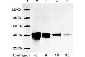 Lane 1: MarkerLane 2-5: 40 ng, 8 ng, 1. (RFP antibody)