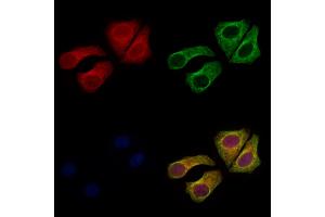 ABIN7094075 and ABIN7098119 staining Hela cells by IF/ICC. (ARL5B antibody  (Internal Region))