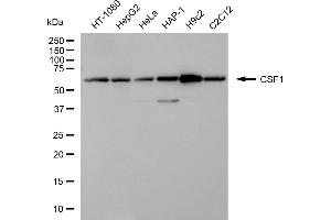 Western blotting analysis using CSF1 antibody (ABIN7798131).