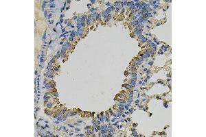 Immunohistochemistry of paraffin-embedded mouse lung using PSAT1 Antibody (ABIN6293473) at dilution of 1:100 (40x lens).