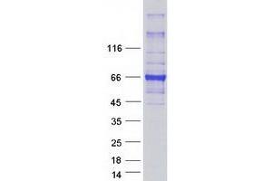 Validation with Western Blot