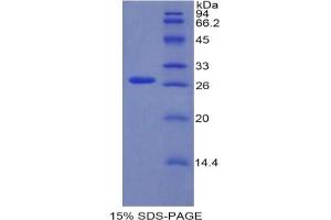 SDS-PAGE analysis of Mouse RUNX2 Protein.