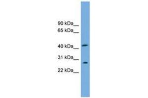 Image no. 1 for anti-Rab9 Effector Protein with Kelch Motifs (RABEPK) (N-Term) antibody (ABIN6744933) (RABEPK antibody  (N-Term))