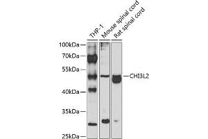 Western blot analysis of extracts of various cell lines, using CHI3L2 antibody (ABIN6132056, ABIN6138529, ABIN6138530 and ABIN6223574) at 1:1000 dilution. (CHI3L2 antibody  (AA 27-390))