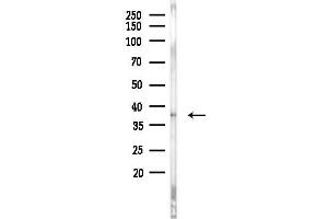 anti-SUMO1 Activating Enzyme Subunit 1 (SAE1) (Internal Region) antibody